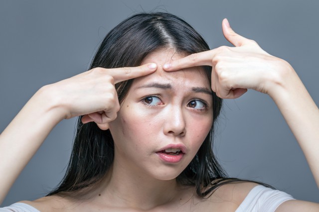 闭口怎么去除小妙招，告诉你简单的去除技巧 健康 第3张