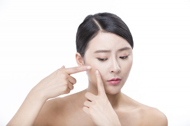 去痘痘的日常方法，教你简单祛痘小妙招 健康 第1张
