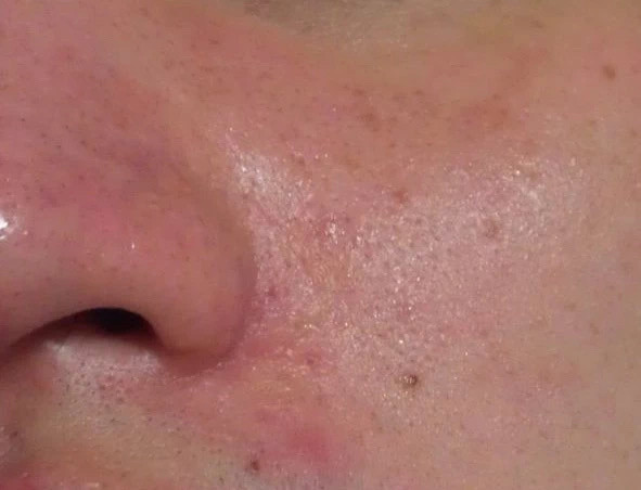 皮肤“干净”的女生，才是真的气质好看！这个护肤细节很值得学 美容健康 第4张