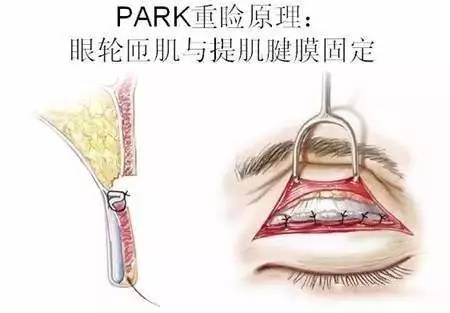 为什么孙峰医生的手术还需要排队预约? 健康 第10张