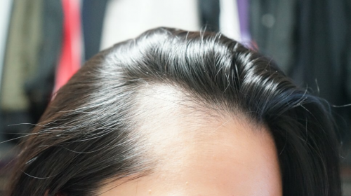 脱发严重，就用Dr.FORHAIR洗发水增发密发富含高浓缩的营养物质 美容健康 第1张