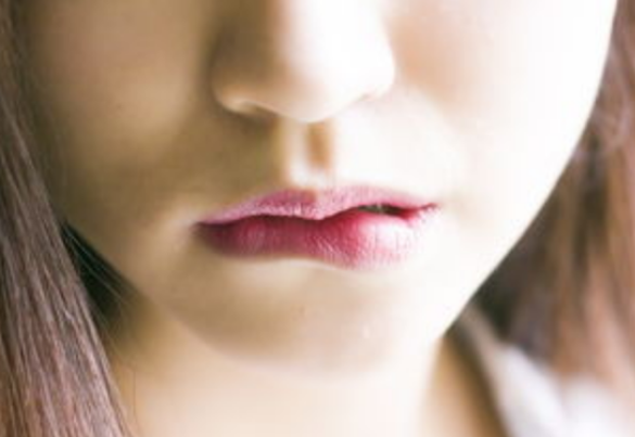 这4种“唇形”看着不美观，神仙颜值很难拯救，希望大家别踩雷 健康 第18张