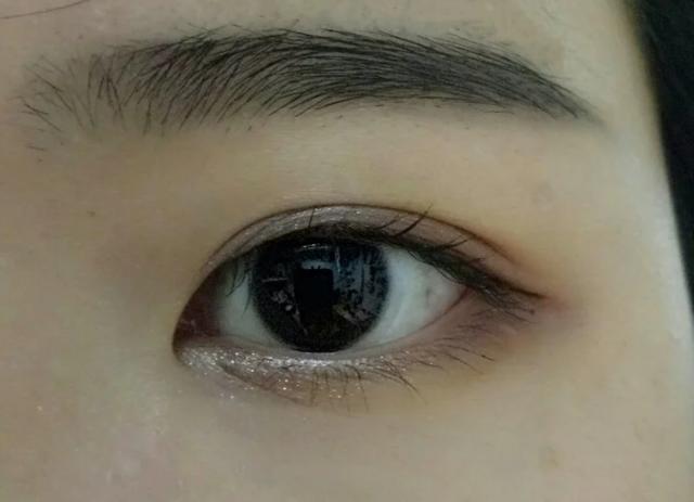 各种眼睛类型的图片详细介绍 健康 第1张
