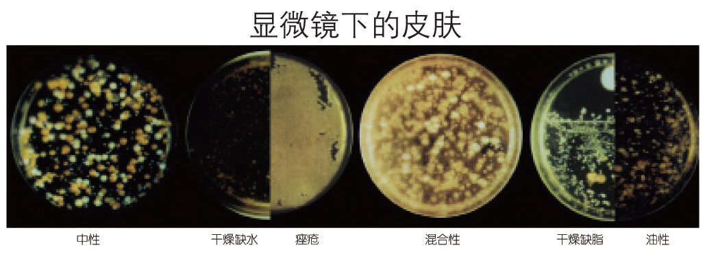 科学塑造肌肤健康之美——德国MBK皮菌微生态护肤 健康 第3张